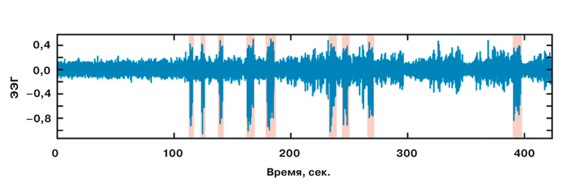 Эпилепсию диагностирует искусственный интеллект 