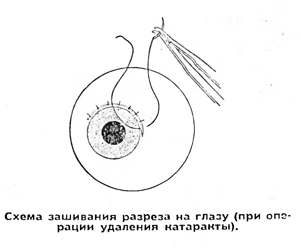 МИКРОХИРУРГИЯ ГЛАЗА БУДУЩЕЕ В НАСТОЯЩЕМ