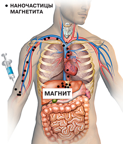 Магнитный ответ «плохим клеткам»
