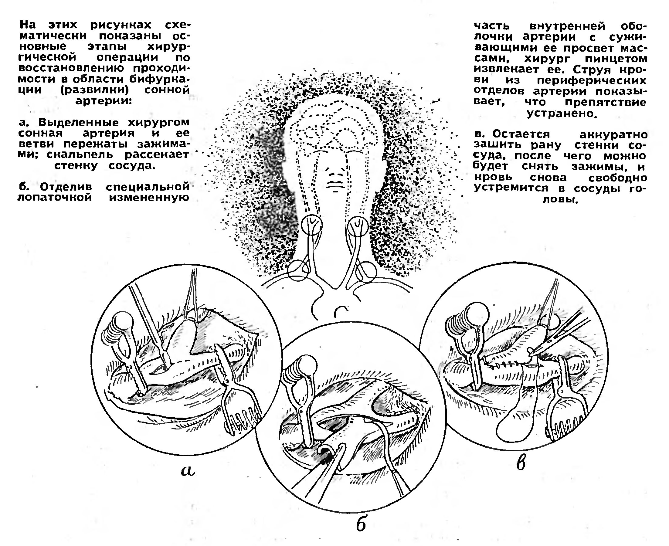 ХИРУРГИЯ — ПРОБЛЕМЫ, ПОИСКИ   